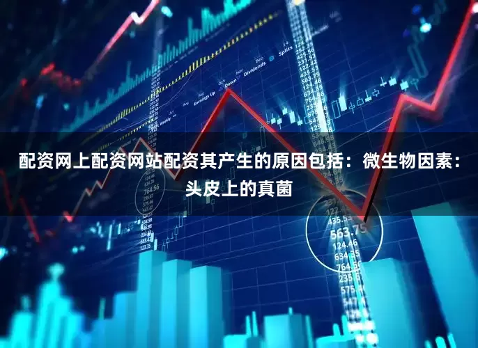 配资网上配资网站配资其产生的原因包括：微生物因素：头皮上的真菌